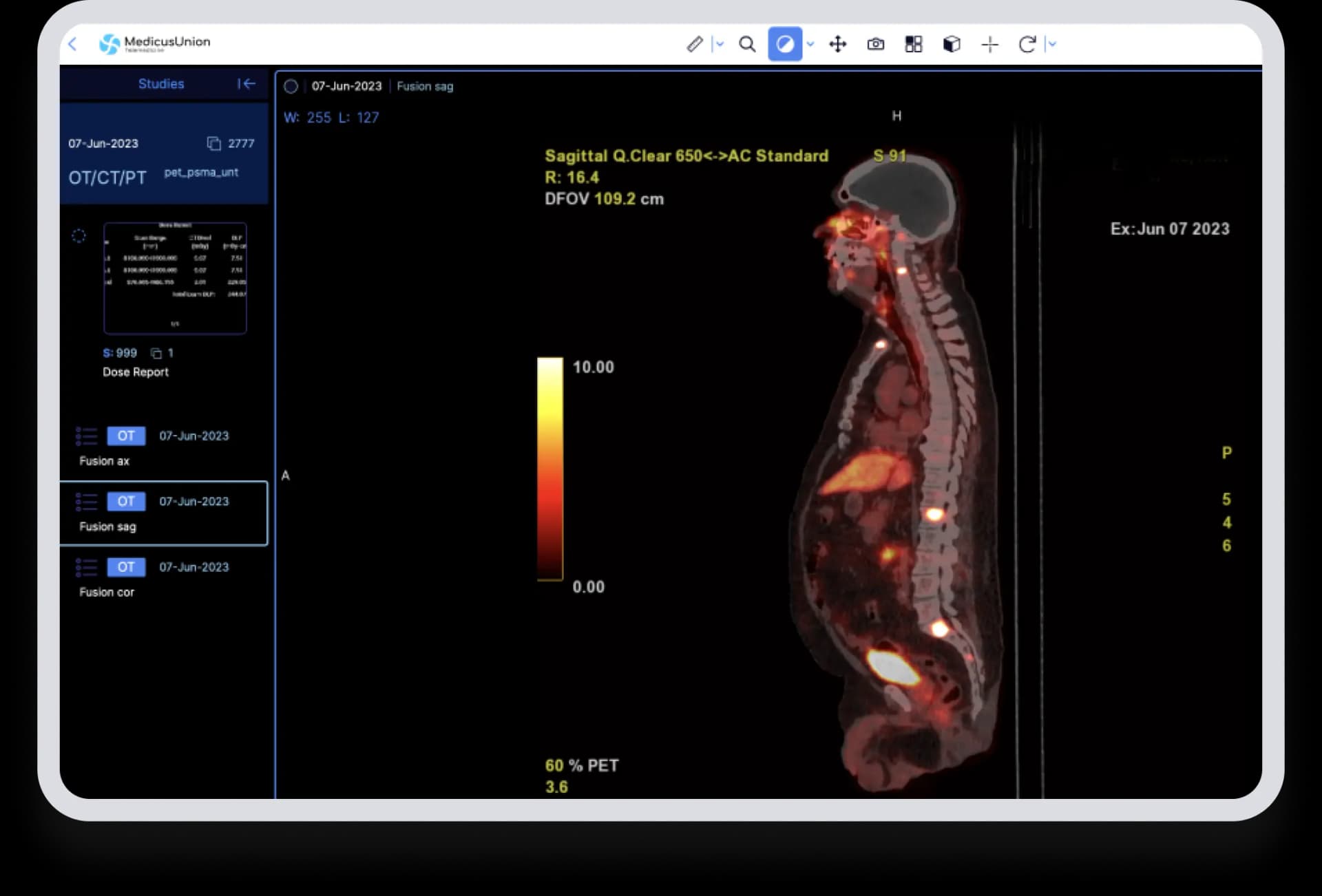 Access your medical records easily with MedicusUnion's DICOM Viewer.