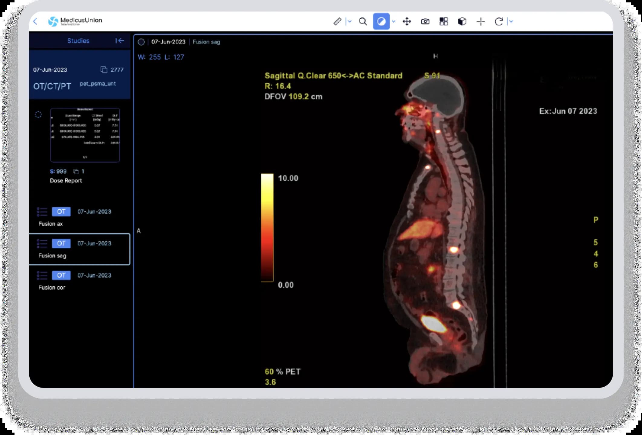 Access your medical records easily with MedicusUnion's DICOM Viewer.