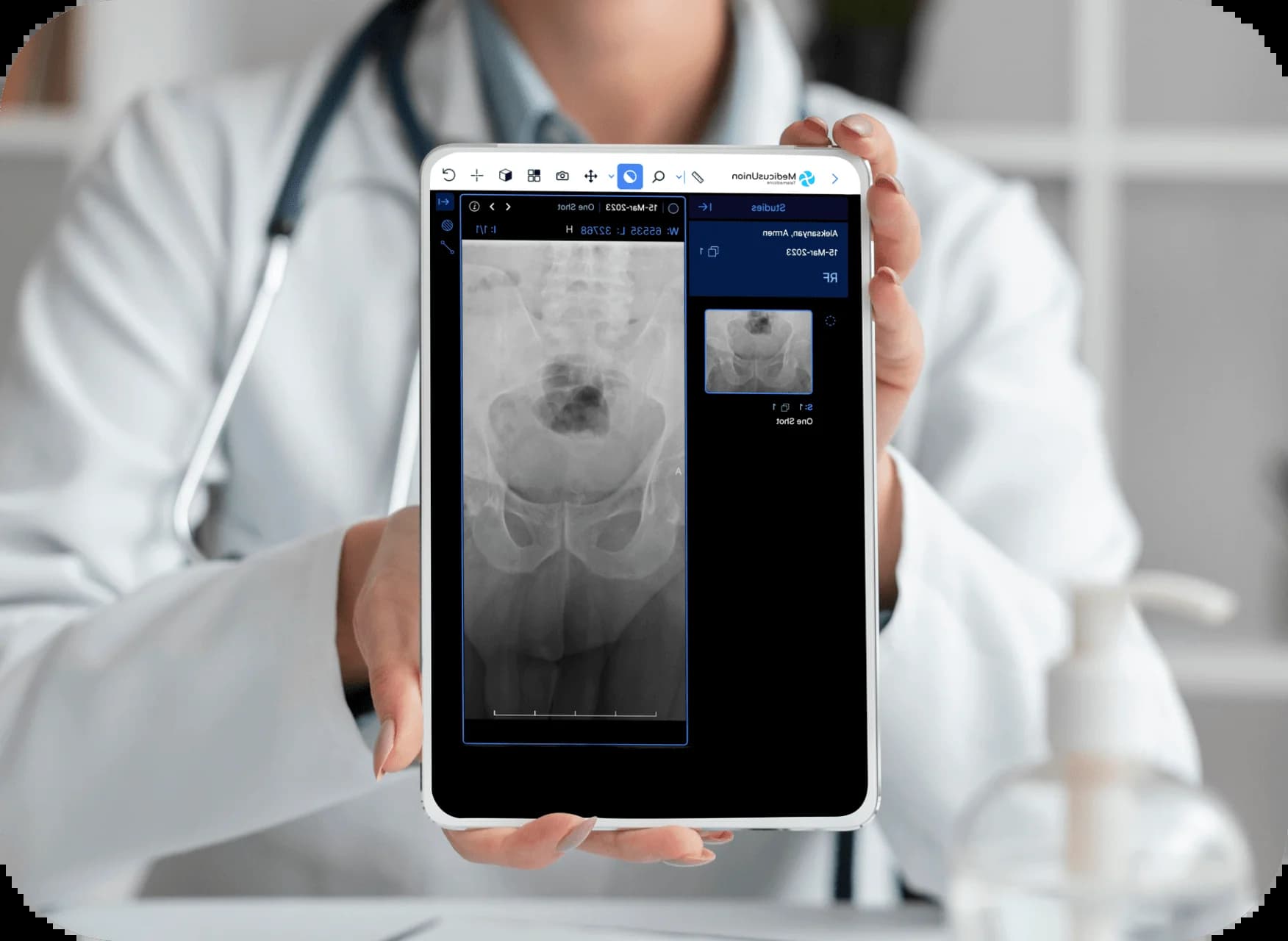 Сканирование таза, отображаемое на планшете врача, дает ценную информацию медицинским работникам.