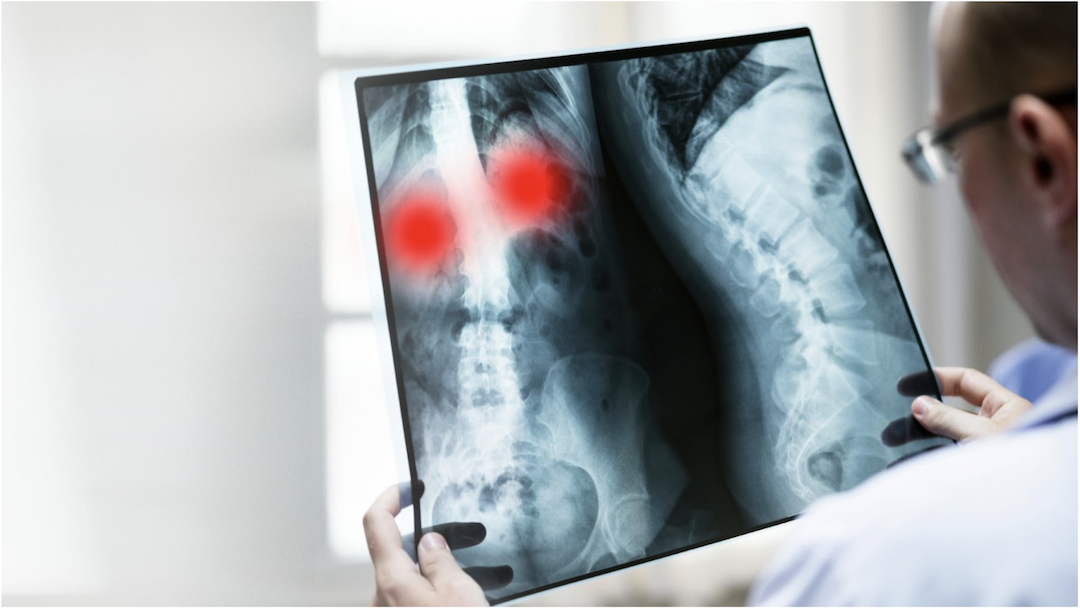 Radiology in modern medicine