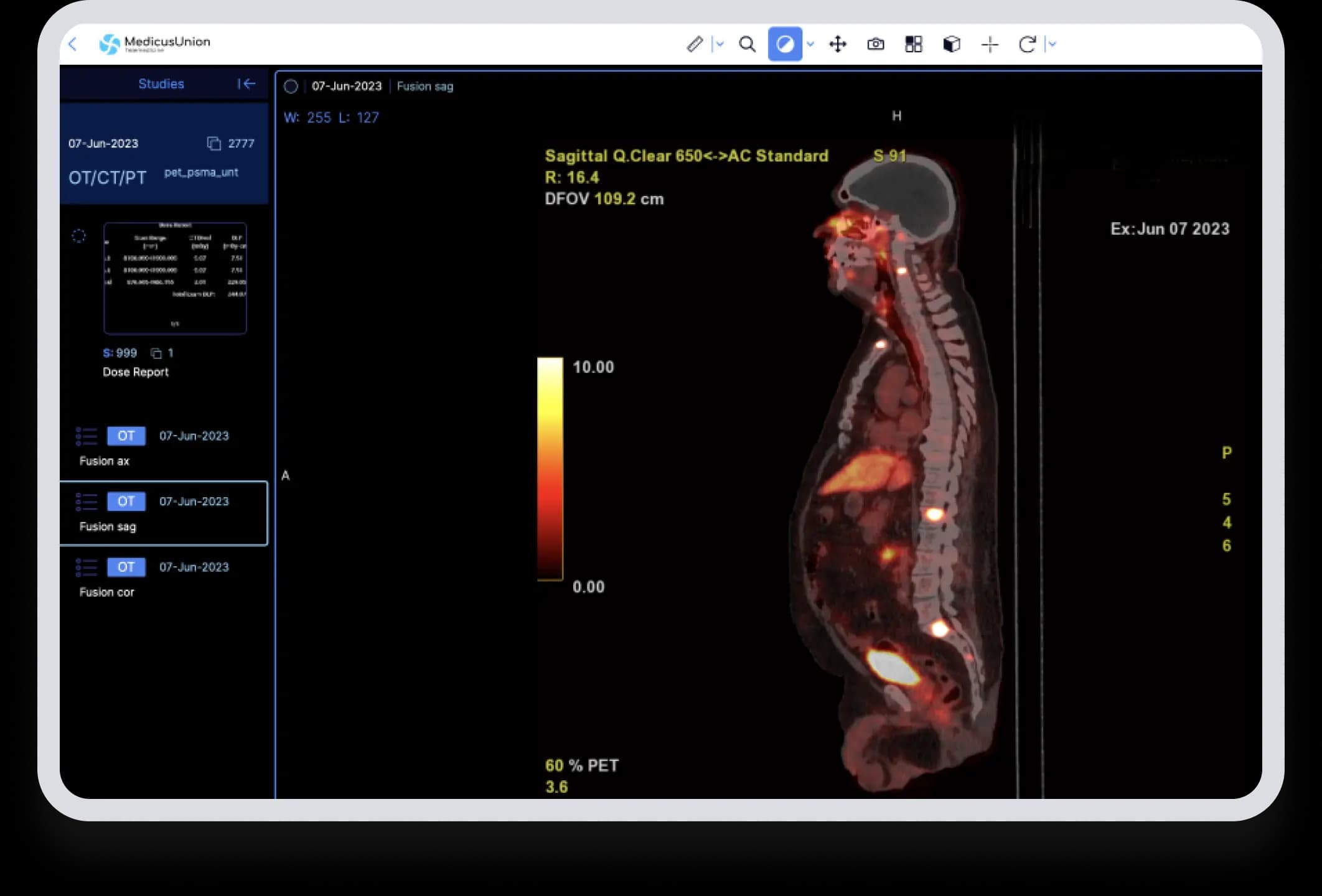 Access your medical records easily with MedicusUnion's DICOM Viewer.